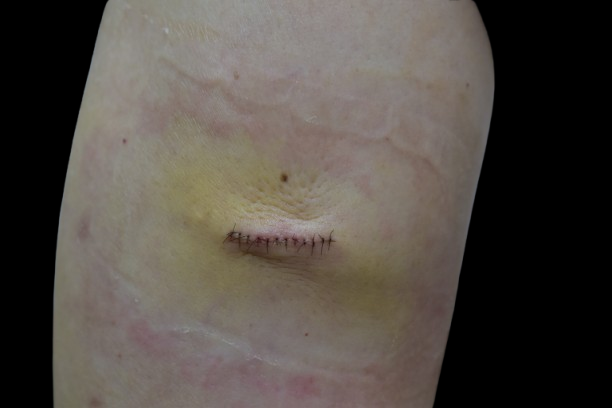 DSC_0156-removebg-preview