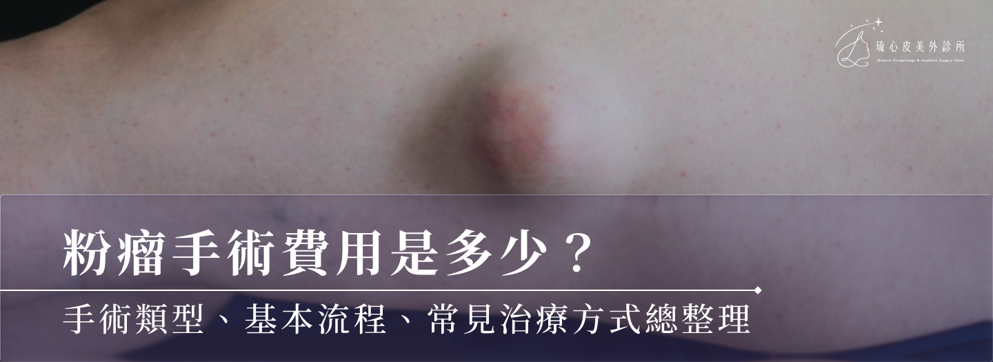 粉瘤手術費用是多少？手術類型、基本流程、常見治療方式總整理