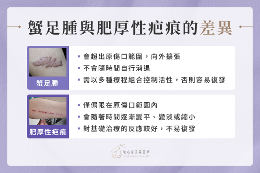 蟹足腫與肥厚性疤痕的差異